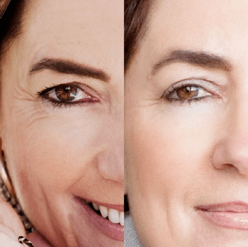 anti-aging, breast enhancement, Deletebreast reconstruction
