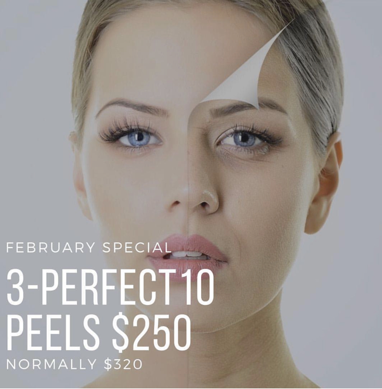 skin peel special