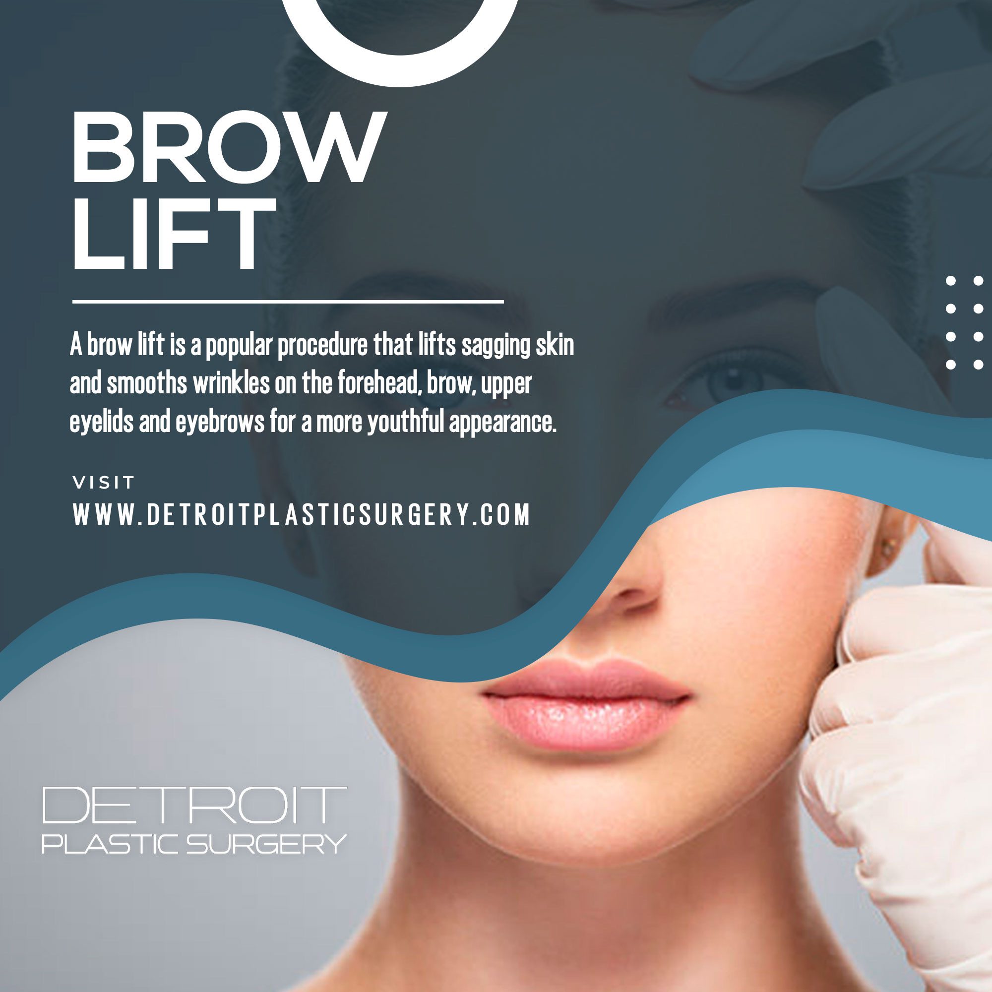 Brow Lift at Detroit Plastic Surgery